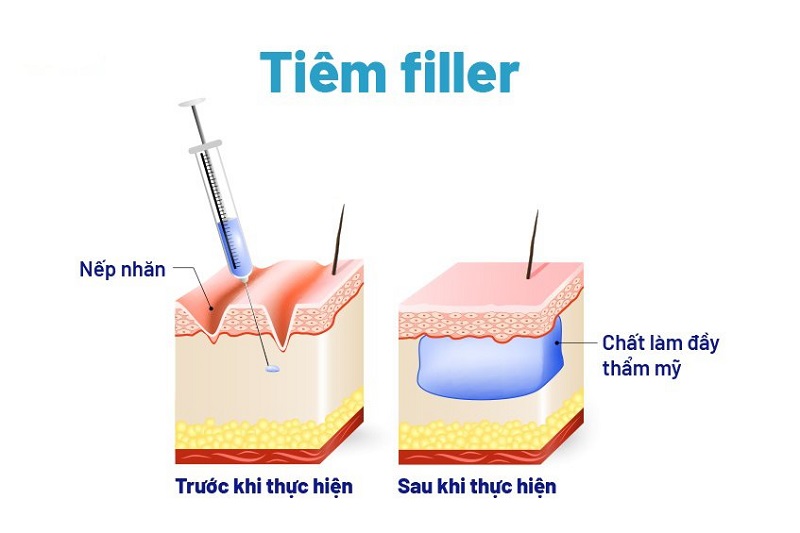 tiem filter tai miss tram