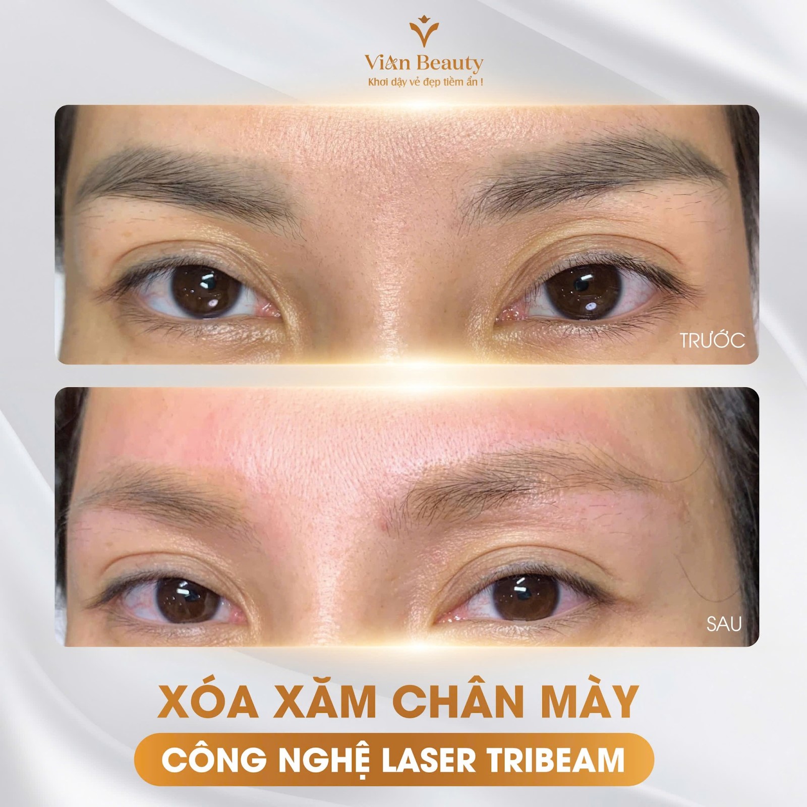 Bảng giá điêu khắc mày môi tại Vian Beauty, chất lượng ra sao? 9 xoa xam chan may