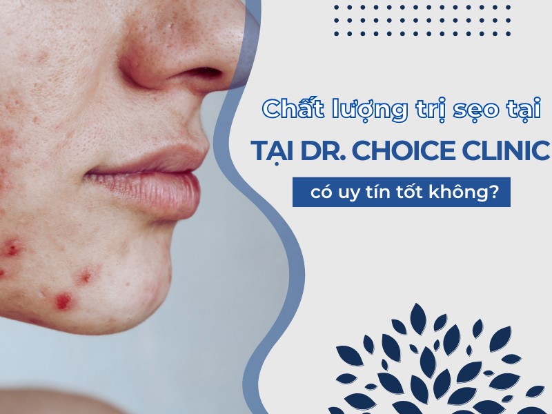 Trải Nghiệm Chất Lượng Trị Sẹo Ở Dr. Choice Clinic