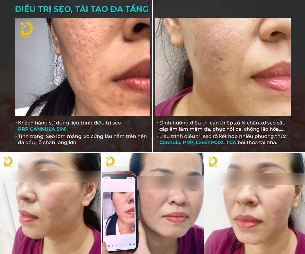 tai tao da