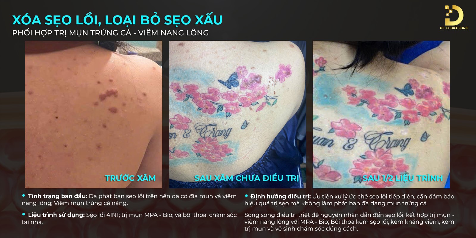 xoa seo loi