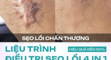 tri seo loi tai dr choice uy tin